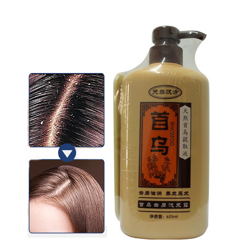 Hair Care Dandruff - Xampu profissional natural de medicina chinesa,