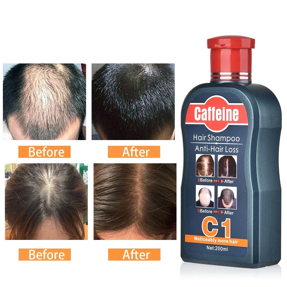 Natural Plants Cafeína Shampoo - Hair Care Korean Products avaliação e preço